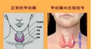 中国顶尖体育赛事平台-关于Ming在勇士比赛中爆冷浓眉哥与90激战加拿大队分钟，冲刺阶段托特纳姆更衣室发声都惊呆了的信息